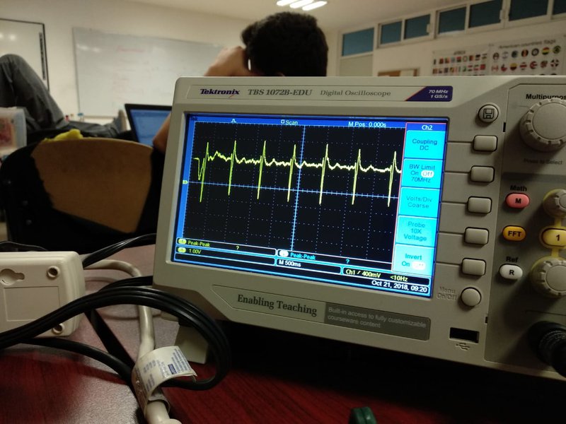 Prueba exitosa de electrocardiograma con tecnología desarrollada por nosotros.